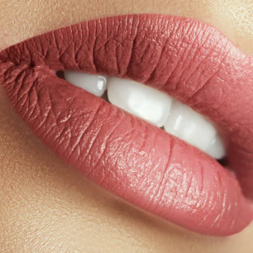 lip filler